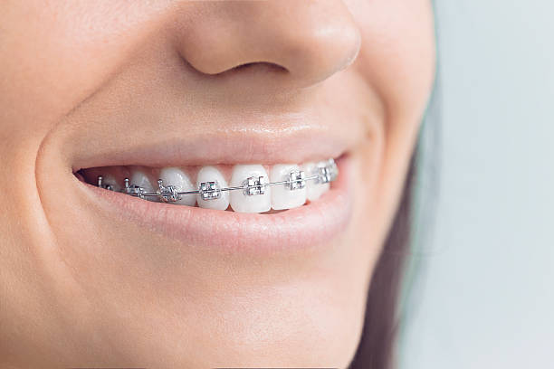 Best Tooth Extraction  in Bonita, CA